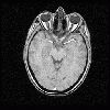 Axial (Inferior).jpg